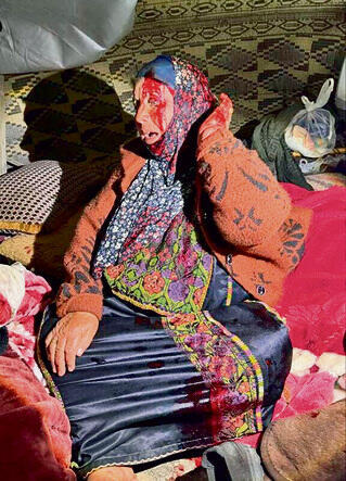 הפצועים שנפגעו בעקבות פשיטת המתנחלים yk14503712