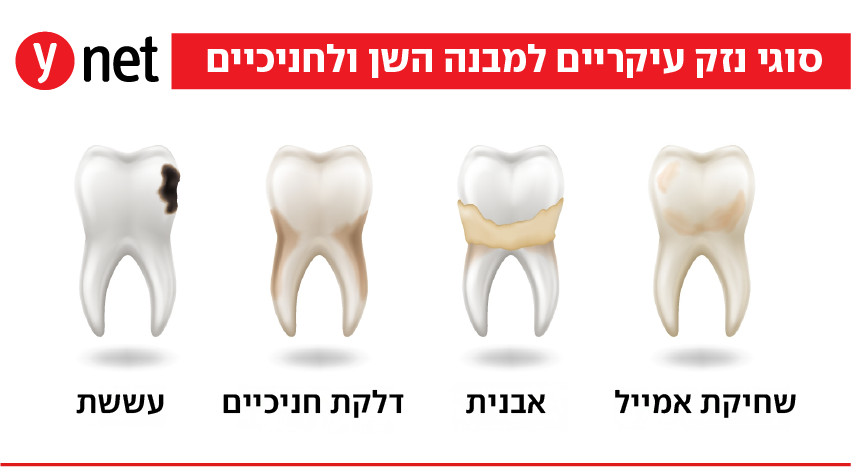 נזקי שיניים (צילום: Shutterstock) נזקי שיניים