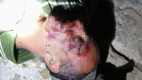 הפלסטינים שסובלים מאלימות מתנחלים חסרי אונים: 