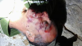 הותקפו על ידי מתנחלים במסאפר יטא