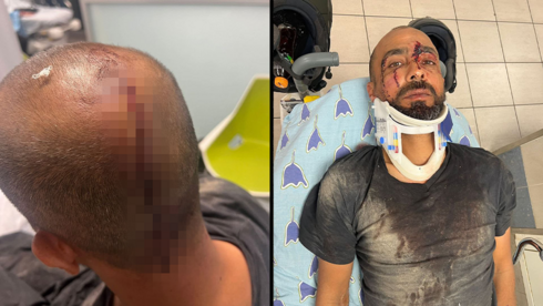 „צעקו קריאות גזעניות וגנבו 5,000 שקל”: אחמד הותקף בת”א – המשטרה לא הגיעה