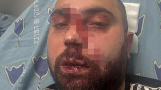 אגבאריה, שהותקף בתל אביב. "אי אפשר לשתוק על זה" מחמוד אגבאריה שהותקף בתל אביב