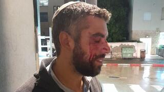 הרב לאחר התקיפה הרב לאחר התקיפה