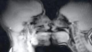 MRI יחסי מין