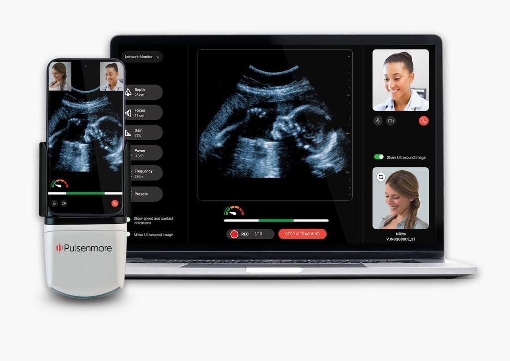 האולטרסאונד הביתי של החברה