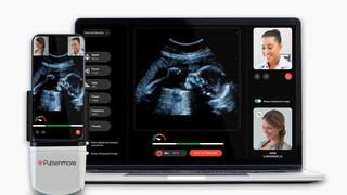 האולטרסאונד הביתי של החברה