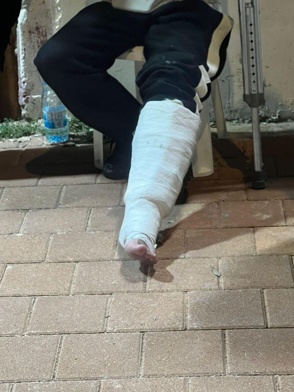 הגבס והאבוקות (צילום: משטרת ישראל) הגבס והאבוקות