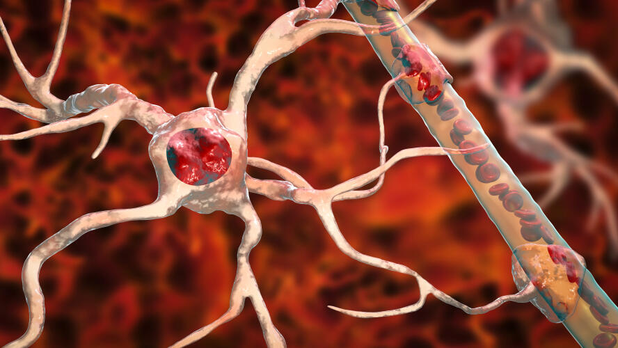 Toxoplasma gondii 