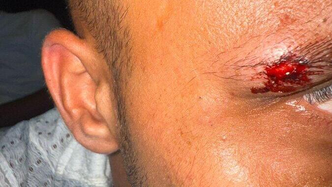 Injuries sustained by the Israelis הישראלים שהותקפו