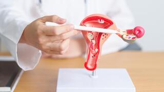 No Longer One Approach for All: Behind Personalized Treatment for Women with Ovarian Cancer