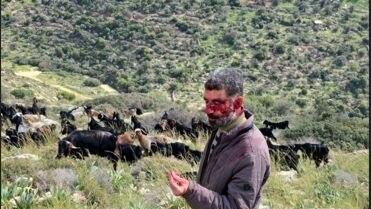 רועה צאן שהותקף