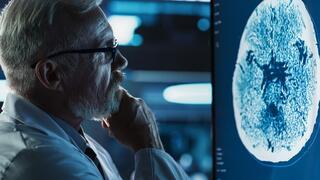 ct מוח הדמיה