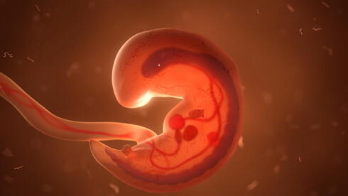 Israeli held in Cyprus embryo trafficking probe