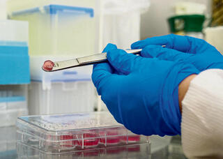 רקמה מודפסת עם תאים חיים | צילומים: הקריה הרפואית רמב"ם