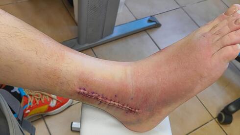 Встаете ночью в туалет? Это важно знать мужчинам, чтобы не упасть в обморок