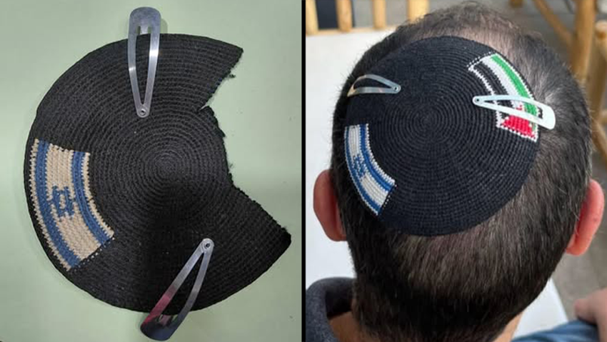 סינקלר עם הכיפה לראשו, ואחרי שקיבל אותה חזרה ללא דגל פלסטין (צילום: מתוך פייסבוק) הכיפה שנגזרה על ידי שוטרים