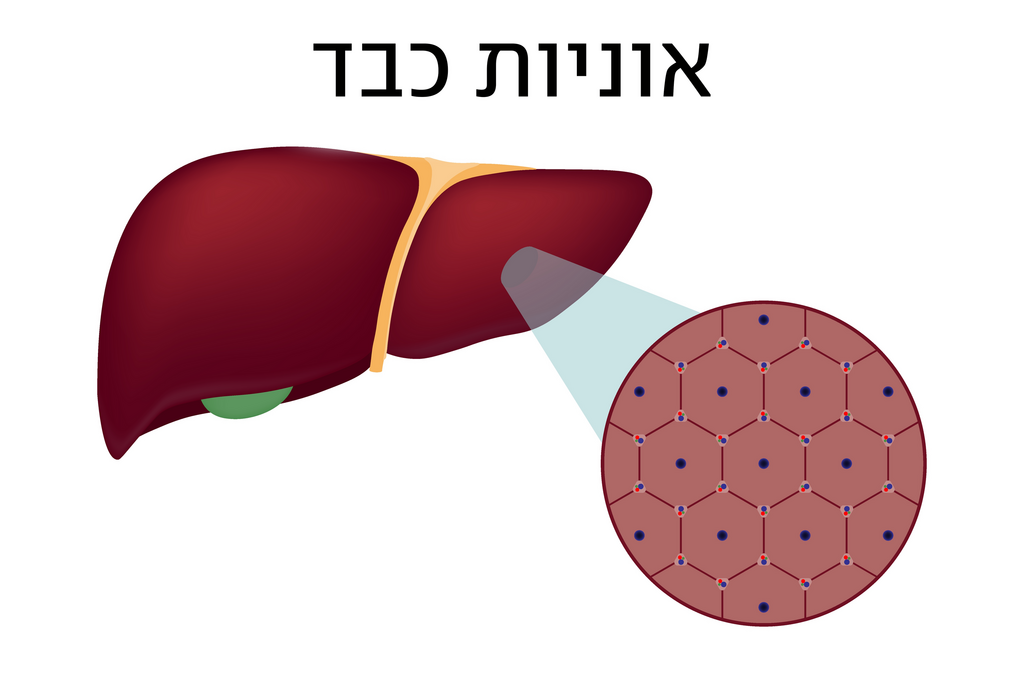 אוניות כבד