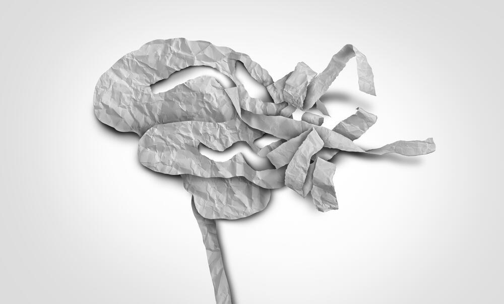 מחלות נוירודגנרטיביות (צילום: shutterstock) מחלות נוירודגנרטיביות