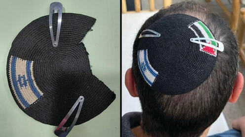 לפני ואחרי. הכיפה של סינקלר