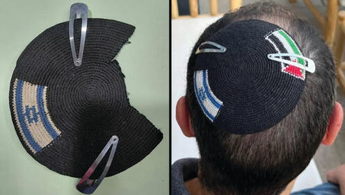 לפני ואחרי. הכיפה של סינקלר