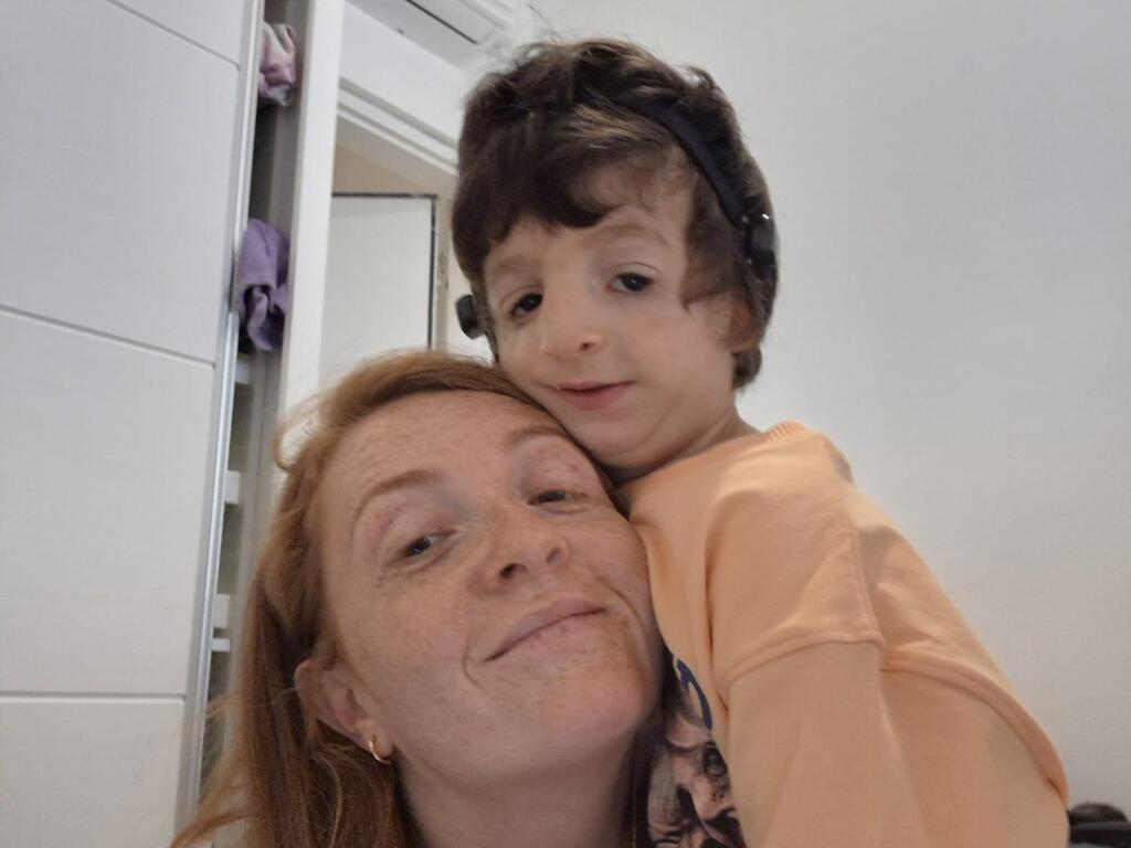 דיאנה בר אדיר בר תסמונת טריצ'ר קולינס