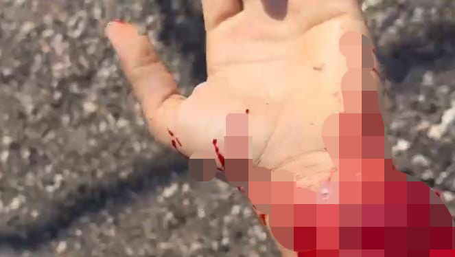צעיר הותקף קשות במכון שטיפה: "ויכוח סתמי כמעט הסתיים ברצח"
