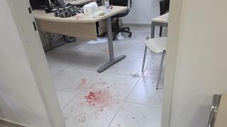 סיוט במרפאה: פסיכיאטר הותקף בראשו ונדקר במברג, המטפלות הצילו אותו